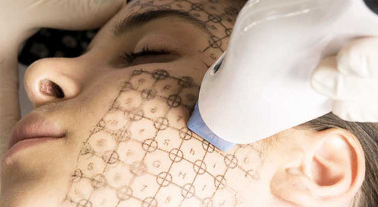 切らないリフトアップ Thermage (Nonsurgical lift up)